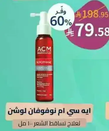 Hair loss treatment spray, 100 ml.